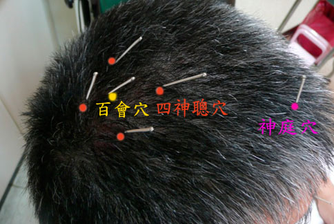 牡丹江亚健康调理师证报名时间及报名流程